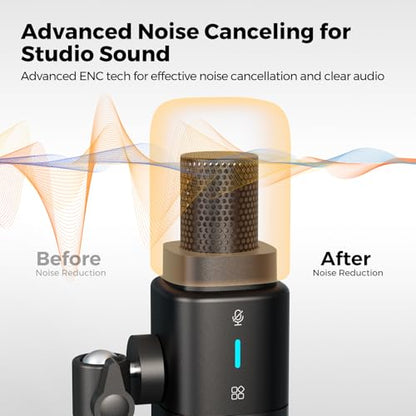 AM25X Gen2 XLR/USB Condenser Microphone with Desk Stand | Noise Canceling/Volume Control/Headphone Jack/Mute, Podcast Microphone for PC/Audio Mixer/Stream/Podcast/Gaming/Music Record - style: 1-Pack