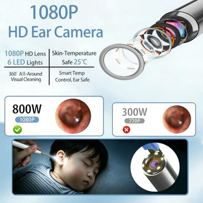 Ear Wax Removal Kit, Ear Cleaner with Camera, 1080P HD Ear Camera with Light, Ear Cleaning Camera Ear Pick Set, Ear Wax Removal Tool Camera Compatible with iOS & Android(Blue) - color: Blue