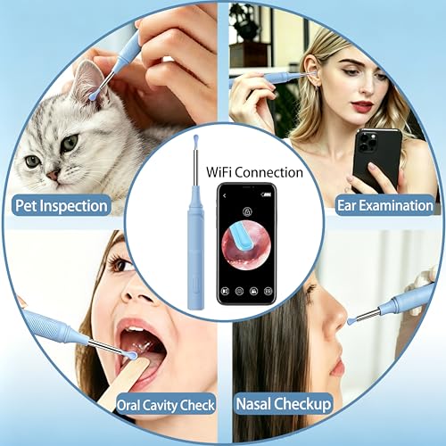 Ear Wax Removal Kit, Ear Cleaner with Camera, 1080P HD Ear Camera with Light, Ear Cleaning Camera Ear Pick Set, Ear Wax Removal Tool Camera Compatible with iOS & Android(Blue) - color: Blue